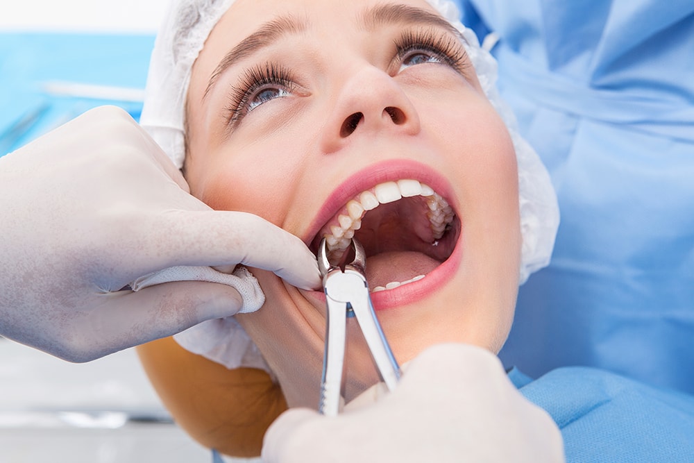 Tips for Faster Recovery After a Tooth Extraction